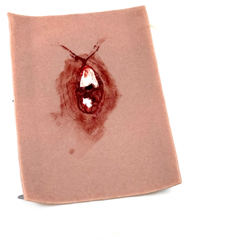 Sårmarkörskada öppen femurfraktur, Svenska räddningsprodukter en av våra beprövade produkter inom första hjälpen. Det är alltid ett tryggt val med Sårmarkörskada öppen femurfraktur från Prestofirstaid.se